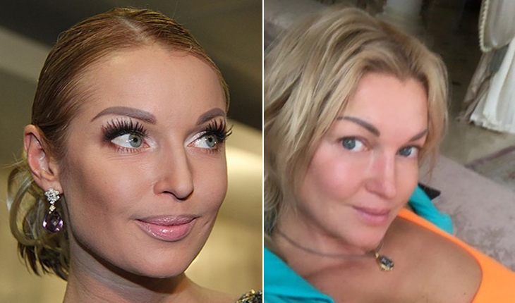 30 фото российских звезд без макияжа