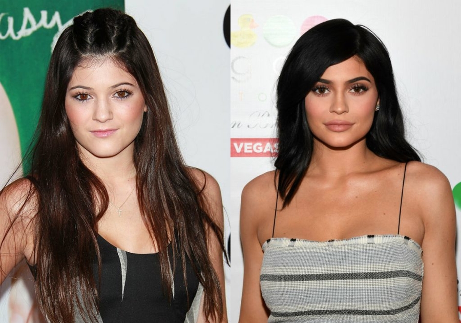 Incredible Celebrity Transformations: Before-And-After Pics