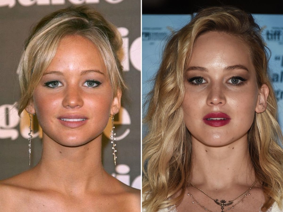 Incredible Celebrity Transformations: Before-And-After Pics